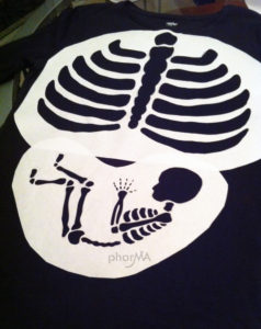 Bones